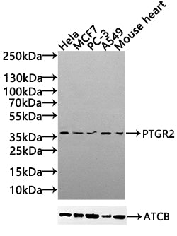 Western Blot Positive WB detected in: Hela whole cell lysate(30µg), MCF7 whole cell lysate(30µg), PC-3 whole cell lysate(30µg), A549 whole cell lysate(20µg),Mouse Heart tissue lysate(30µg) All lanes:PTGR2 antibody at 1:1000 Secondary Goat polyclon...