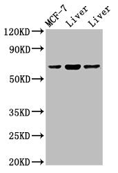 Western Blot Positive WB detected in: Rat liver tissue, Mouse liver issue All lanes: PTH1R antibody at 2ug/ml Secondary Goat polyclonal to rabbit IgG at 1/50000 dilution Predicted band size: 67 kDa Observed band size: 67 kDa