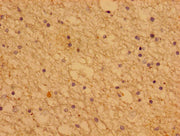 Immunohistochemistry of paraffin-embedded human brain tissue using CSB-PA018991LA01HU at dilution of 1:100