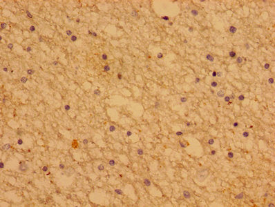 Immunohistochemistry of paraffin-embedded human brain tissue using CSB-PA018991LA01HU at dilution of 1:100