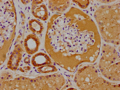 IHC image of CSB-PA018996LA01HU diluted at 1:100 and staining in paraffin-embedded human kidney tissue performed on a Leica BondTM system. After dewaxing and hydration, antigen retrieval was mediated by high pressure in a citrate buffer (pH 6.0)....