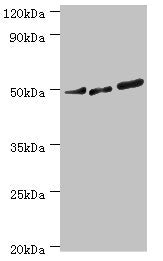 "Western blot All lanes: PTPN1 antibody at 2µg/ml Lane 1: Jurkat whole cell lysate Lane 2: A431 whole cell lysate Lane 3: PC-3 whole cell lysate Secondary Goat polyclonal to rabbit IgG at 1/10000 dilution Predicted band size: 50 kDa Observed band...