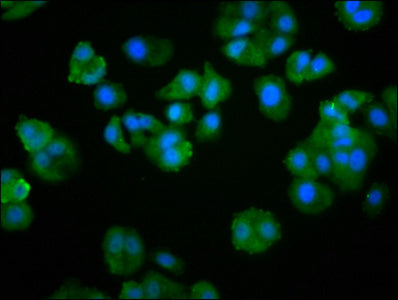 Immunofluorescence staining of HepG2 cells with CSB-PA019036LA01HU at 1:266, counter-stained with DAPI. The cells were fixed in 4% formaldehyde, permeabilized using 0.2% Triton X-100 and blocked in 10% normal Goat Serum. The cells were then incuba...