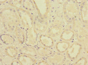 Immunohistochemistry of paraffin-embedded human kidney tissue using CSB-PA019041ESR1HU at dilution of 1:100