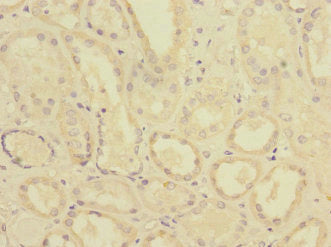 Immunohistochemistry of paraffin-embedded human kidney tissue using CSB-PA019041ESR1HU at dilution of 1:100