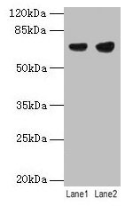 Western blot All lanes: PTPN6 antibody at 12µg/ml Lane 1: Jurkat whole cell lysate Lane 2: Raji whole cell lysate Secondary Goat polyclonal to rabbit IgG at 1/10000 dilution Predicted band size: 68, 64, 71 kDa Observed band size: 68 kDa