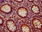 IHC image of CSB-PA019045LA01HU diluted at 1:400 and staining in paraffin-embedded human appendix tissue performed on a Leica BondTM system. After dewaxing and hydration, antigen retrieval was mediated by high pressure in a citrate buffer (pH 6.0)...
