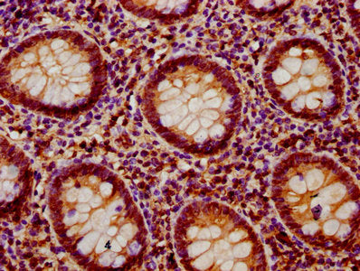 IHC image of CSB-PA019045LA01HU diluted at 1:400 and staining in paraffin-embedded human appendix tissue performed on a Leica BondTM system. After dewaxing and hydration, antigen retrieval was mediated by high pressure in a citrate buffer (pH 6.0)...