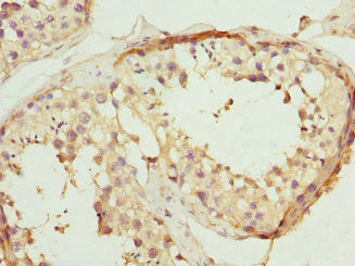 Immunohistochemistry of paraffin-embedded human testis tissue using CSB-PA019048ESR2HU at dilution of 1:100