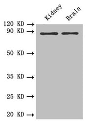 Western blot All lanes: PTPRE antibody at 0.6 ug/ml Lane 1: Mouse kidney tissue Lane 2: Mouse brain tissue Secondary Goat polyclonal to rabbit IgG at 1/10000 dilution Predicted band size: 81, 75, 72 kDa Observed band size: 81 kDa