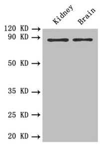 Western blot All lanes: PTPRE antibody at 0.6 ug/ml Lane 1: Mouse kidney tissue Lane 2: Mouse brain tissue Secondary Goat polyclonal to rabbit IgG at 1/10000 dilution Predicted band size: 81, 75, 72 kDa Observed band size: 81 kDa