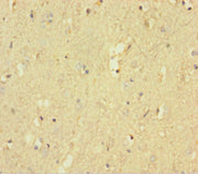 Immunohistochemistry of paraffin-embedded human brain tissue using CSB-PA019068LA01HU at dilution of 1:100