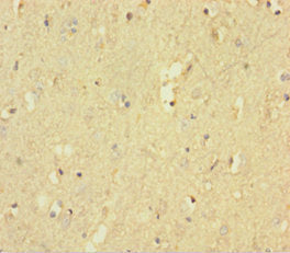 Immunohistochemistry of paraffin-embedded human brain tissue using CSB-PA019068LA01HU at dilution of 1:100