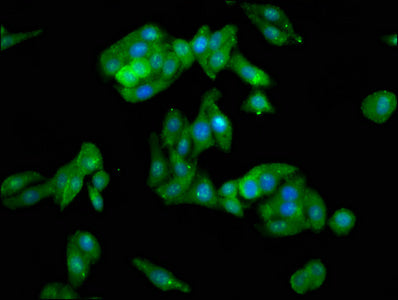 Immunofluorescence staining of HepG2 cells with CSB-PA019070LA01HU at 1:100, counter-stained with DAPI. The cells were fixed in 4% formaldehyde, permeabilized using 0.2% Triton X-100 and blocked in 10% normal Goat Serum. The cells were then incuba...