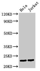 Western Blot Positive WB detected in: Hela whole cell lysate, Jurkat whole cell lysate All lanes: PTTG1 antibody at 3µg/ml Secondary Goat polyclonal to rabbit IgG at 1/50000 dilution Predicted band size: 23 kDa Observed band size: 23 kDa