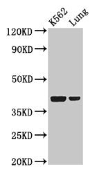 Western Blot Positive WB detected in: K562 whole cell lysate, Rat lung tissue All lanes: PTX3 antibody at 2µg/ml Secondary Goat polyclonal to rabbit IgG at 1/50000 dilution Predicted band size: 42 kDa Observed band size: 42 kDa