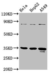 Western Blot Positive WB detected in: Hela whole cell lysate, HepG2 whole cell lysate, A549 whole cell lysate All lanes: PURA antibody at 4.7µg/ml Secondary Goat polyclonal to rabbit IgG at 1/50000 dilution Predicted band size: 35 kDa Observed ban...