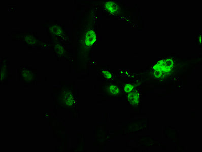 Immunofluorescence staining of U251 cells with CSB-PA019092HA01HU at 1:166, counter-stained with DAPI. The cells were fixed in 4% formaldehyde, permeabilized using 0.2% Triton X-100 and blocked in 10% normal Goat Serum. The cells were then incubat...