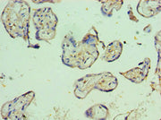 Immunohistochemistry of paraffin-embedded human placenta tissue using CSB-PA019093ESR2HU at dilution of 1:100