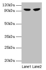 Western blot All lanes: PYGL antibody at 2µg/ml Lane 1: 293T whole cell lysate Lane 2: HepG2 whole cell lysate Secondary Goat polyclonal to rabbit IgG at 1/10000 dilution Predicted band size: 98, 94 kDa Observed band size: 98 kDa