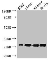 Western Blot Positive WB detected in: K562 whole cell lysate, Mouse liver tissue, Mouse kidney tissue, Mouse brain tissue All lanes: QDPR antibody at 3µg/ml Secondary Goat polyclonal to rabbit IgG at 1/50000 dilution Predicted band size: 26, 23 kD...