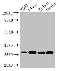 Western Blot Positive WB detected in: K562 whole cell lysate, Mouse liver tissue, Mouse kidney tissue, Mouse brain tissue All lanes: QDPR antibody at 3µg/ml Secondary Goat polyclonal to rabbit IgG at 1/50000 dilution Predicted band size: 26, 23 kD...