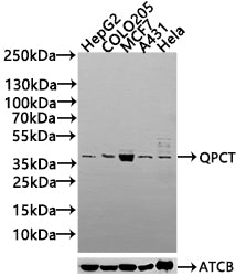 Western blot All lanes: QPCT antibody at 2µg/ml Lane 1: Rat muscle tissue Lane 2: Rat adrenal gland tissue Secondary Goat polyclonal to rabbit IgG at 1/10000 dilution Predicted band size: 41, 36 kDa Observed band size: 41 kDa