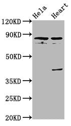Western Blot Positive WB detected in: Hela whole cell lysate, Rat heart tissue All lanes: QSOX1 antibody at 5.6ug/ml Secondary Goat polyclonal to rabbit IgG at 1/50000 dilution Predicted band size: 83 kDa Observed band size: 83 kDa