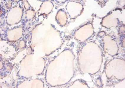 Immunohistochemistry of paraffin-embedded human thyroid tissue using CSB-PA01915A0Rb at dilution of 1:100