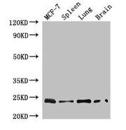 Western Blot Positive WB detected in: MCF-7 whole cell lysate, Mouse spleen tissue, Mouse lung tissue, Mouse brain tissue All lanes: RAB25 antibody at 4µg/ml Secondary Goat polyclonal to rabbit IgG at 1/50000 dilution Predicted band size: 24 kDa O...