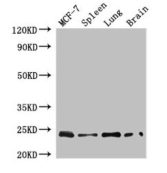 Western Blot Positive WB detected in: MCF-7 whole cell lysate, Mouse spleen tissue, Mouse lung tissue, Mouse brain tissue All lanes: RAB25 antibody at 4µg/ml Secondary Goat polyclonal to rabbit IgG at 1/50000 dilution Predicted band size: 24 kDa O...