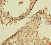 Immunohistochemistry of paraffin-embedded human testis tissue using CSB-PA019178ESR2HU at dilution of 1:100