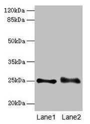 Western blot All lanes: RAB3B antibody at 4µg/ml Lane 1: Mouse brain tissue Lane 2: U87 whole cell lysate Secondary Goat polyclonal to rabbit IgG at 1/10000 dilution Predicted band size: 25 kDa Observed band size: 25 kDa