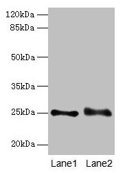 Western blot All lanes: RAB3B antibody at 4µg/ml Lane 1: Mouse brain tissue Lane 2: U87 whole cell lysate Secondary Goat polyclonal to rabbit IgG at 1/10000 dilution Predicted band size: 25 kDa Observed band size: 25 kDa
