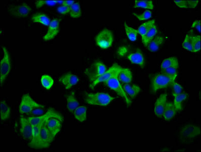 Immunofluorescence staining of MCF-7 cells with CSB-PA019203LA01HU at 1:33, counter-stained with DAPI. The cells were fixed in 4% formaldehyde, permeabilized using 0.2% Triton X-100 and blocked in 10% normal Goat Serum. The cells were then incubat...