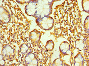 Immunohistochemistry of paraffin-embedded human small intestine tissue using CSB-PA019211ESR1HU at dilution of 1:100