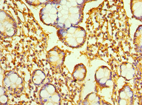 Immunohistochemistry of paraffin-embedded human small intestine tissue using CSB-PA019211ESR1HU at dilution of 1:100