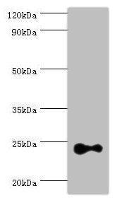 Western blot All lanes: Ras-related protein Rab-4A antibody at 2ug/ml + Mouse brain tissue Secondary Goat polyclonal to rabbit IgG at 1/10000 dilution Predicted band size: 24 kDa Observed band size: 24 kDa