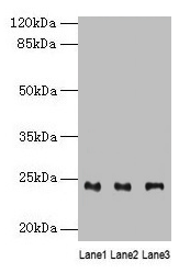 Western blot All lanes: RAB4B antibody at 4µg/ml Lane 1: Mouse stomach tissue Lane 2: Mouse kidney tissue Lane 3: Mouse gonadal tissue Secondary Goat polyclonal to rabbit IgG at 1/10000 dilution Predicted band size: 24, 28 kDa Observed band size:...