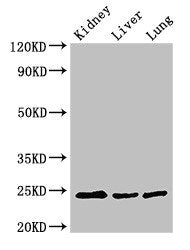 Western Blot Positive WB detected in: Mouse kidney tissue, Mouse liver tissue, Rat lung tissue All lanes: RAB5A antibody at 3ug/ml Secondary Goat polyclonal to rabbit IgG at 1/50000 dilution Predicted band size: 24, 23 kDa Observed band size: 24 kDa