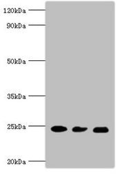 Western blot All lanes: Ras-related protein Rab-5A antibody at 5ug/ml Lane 1: Mouse brain tissue Lane 2: HL60 whole cell lysate Lane 3: Hela whole cell lysate Secondary Goat polyclonal to rabbit IgG at 1/10000 dilution Predicted band size: 24, 23...