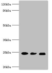Western blot All lanes: Ras-related protein Rab-5A antibody at 5ug/ml Lane 1: Mouse brain tissue Lane 2: HL60 whole cell lysate Lane 3: Hela whole cell lysate Secondary Goat polyclonal to rabbit IgG at 1/10000 dilution Predicted band size: 24, 23...