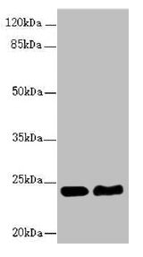 Western blot All lanes: RAB5B antibody at 5.16µg/ml Lane 1: Hela whole cell lysate Lane 2: Jurkat whole cell lysate Secondary Goat polyclonal to rabbit IgG at 1/10000 dilution Predicted band size: 24, 20 kDa Observed band size: 24 kDa