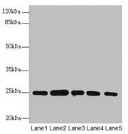 Western blot All lanes: RAB5B antibody at 1.66ug/ml Lane 1: A431 whole cell lysate Lane 2: Hela whole cell lysate Lane 3: Jurkat whole cell lysate Lane 4: 293T whole cell lysate Lane 5: HepG2 whole cell lysate Secondary Goat polyclonal to rabbit I...