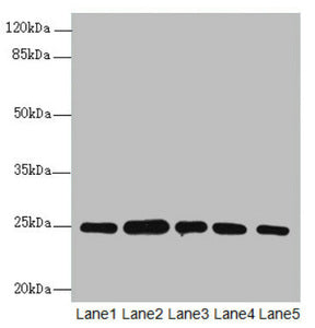 Western blot All lanes: RAB5B antibody at 1.66ug/ml Lane 1: A431 whole cell lysate Lane 2: Hela whole cell lysate Lane 3: Jurkat whole cell lysate Lane 4: 293T whole cell lysate Lane 5: HepG2 whole cell lysate Secondary Goat polyclonal to rabbit I...