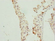 Immunohistochemistry of paraffin-embedded human testis tissue using CSB-PA019215DSR1HU at dilution of 1:100