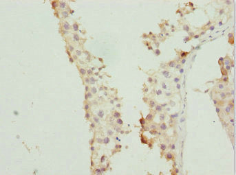 Immunohistochemistry of paraffin-embedded human testis tissue using CSB-PA019215DSR1HU at dilution of 1:100