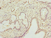 Immunohistochemistry of paraffin-embedded human pancreatic tissue using CSB-PA019215DSR2HU at dilution of 1:100