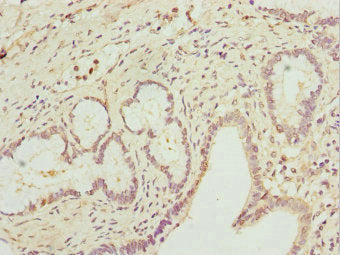 Immunohistochemistry of paraffin-embedded human pancreatic tissue using CSB-PA019215DSR2HU at dilution of 1:100