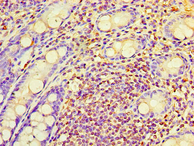 Immunohistochemistry of paraffin-embedded human colon tissue using CSB-PA019216HA01HU at dilution of 1:100